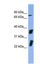 FGFR2 / FGF Receptor 2 Antibody - FGFR2 antibody Western blot of HeLa lysate.  This image was taken for the unconjugated form of this product. Other forms have not been tested.