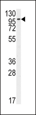 FGFR2 / FGF Receptor 2 Antibody - Western blot of anti-FGFR2 Antibody (N-term R22) in HeLa cell line lysates (35 ug/lane). FGFR2(arrow) was detected using the purified antibody.