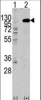 FGFR2 / FGF Receptor 2 Antibody - Western blot of anti-hFGFR2-C808 antibody in 293 cell line lysates transiently transfected with the FGFR2 gene (2 ug/lane). FGFR2 (arrow) was detected using the purified antibody.