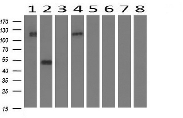 FGFR2 / FGF Receptor 2 Antibody - Western blot of extracts (10ug) from 8 Human tissue by using anti-FGFR2 monoclonal antibody at 1:200 (1: Testis; 2: Uterus; 3: Breast; 4: Brain; 5: Liver; 6: Ovary; 7: Thyroid gland; 8: Colon).