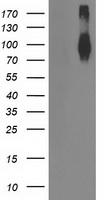 FGFR2 / FGF Receptor 2 Antibody - HEK293T cells were transfected with the pCMV6-ENTRY control (Left lane) or pCMV6-ENTRY FGFR2 (Right lane) cDNA for 48 hrs and lysed. Equivalent amounts of cell lysates (5 ug per lane) were separated by SDS-PAGE and immunoblotted with anti-FGFR2.