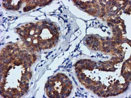 FGFR2 / FGF Receptor 2 Antibody - IHC of paraffin-embedded Human breast tissue using anti-FGFR2 mouse monoclonal antibody.