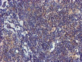 FGFR2 / FGF Receptor 2 Antibody - IHC of paraffin-embedded Human lymphoma tissue using anti-FGFR2 mouse monoclonal antibody.