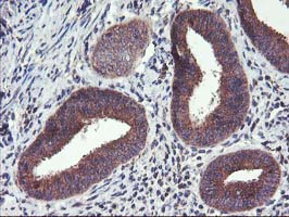 FGFR2 / FGF Receptor 2 Antibody - IHC of paraffin-embedded Human endometrium tissue using anti-FGFR2 mouse monoclonal antibody.