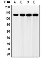 FGFR2 / FGF Receptor 2 Antibody - Western blot analysis of FGFR2 expression in HeLa (A); Jurkat (B); HEK293T (C); mouse liver (D) whole cell lysates.