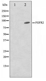 FGFR2 / FGF Receptor 2 Antibody - Western blot of A549 cell lysate using FGFR2 Antibody