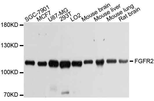 FGFR2 / FGF Receptor 2 Antibody - Western blot analysis of extracts of various cell lines, using FGFR2 antibody at 1:1000 dilution. The secondary antibody used was an HRP Goat Anti-Rabbit IgG (H+L) at 1:10000 dilution. Lysates were loaded 25ug per lane and 3% nonfat dry milk in TBST was used for blocking. An ECL Kit was used for detection and the exposure time was 1s.