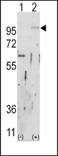 FGFR2 / FGF Receptor 2 Antibody - Western blot of FGFR2 (arrow) using rabbit polyclonal FGFR2 Antibody. 293 cell lysates (2 ug/lane) either nontransfected (Lane 1) or transiently transfected with the FGFR2 gene (Lane 2) (Origene Technologies).