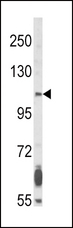 FGFR2 / FGF Receptor 2 Antibody - Western blot of FGFR2 Antibody in NCI-H460 cell line lysates (35 ug/lane). SFGFR2 (arrow) was detected using the purified antibody.