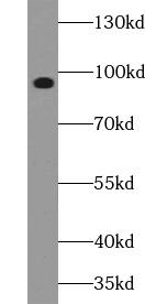 FGFR2 / FGF Receptor 2 Antibody - PC12 cells were subjected to SDS PAGE followed by western blot with FNab09790 (FGFR2 (Phospho-Ser782) antibody) at dilution of 1:1500