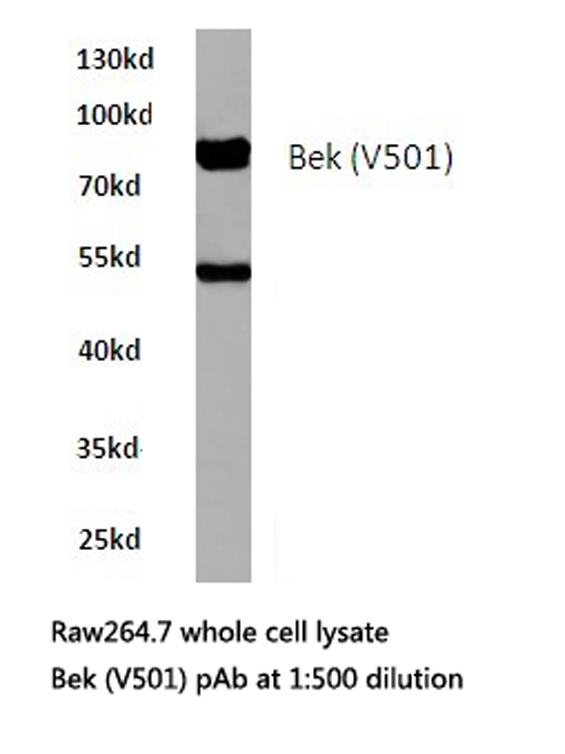 FGFR2 / FGF Receptor 2 Antibody - Western blot of FGFR2 (V501) pAb in extracts from raw264.7 cells.