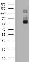 FGFR3 Antibody - HEK293T cells were transfected with the pCMV6-ENTRY control (Left lane) or pCMV6-ENTRY FGFR3 (Right lane) cDNA for 48 hrs and lysed. Equivalent amounts of cell lysates (5 ug per lane) were separated by SDS-PAGE and immunoblotted with anti-FGFR3.