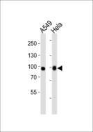 FGFR3 Antibody - Western blot of lysates from A549, HeLa cell line (from left to right) with Mouse Fgfr3 Antibody. Antibody was diluted at 1:1000 at each lane. A goat anti-rabbit IgG H&L (HRP) at 1:5000 dilution was used as the secondary antibody. Lysates at 35 ug per lane.