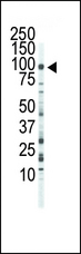 FGFR3 Antibody - Western blot of anti-FGFR3 antibody in Jurkat cell lysate. FGFR3 (Arrow) was detected using purified antibody. Secondary HRP-anti-rabbit was used for signal visualization with chemiluminescence.