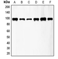 FGFR3 Antibody - Western blot analysis of FGFR3 expression in HeLa (A); A549 (B); T47D (C); mouse kidney (D); mouse heart (E); rat lung (F) whole cell lysates.