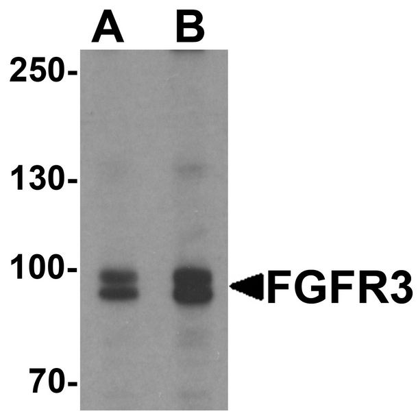 FGFR3 Antibody - Western blot analysis of FGFR3 in SK-N-SH cell lysate with FGFR3 antibody at (A) 0.5 and (B) 1 ug/ml.