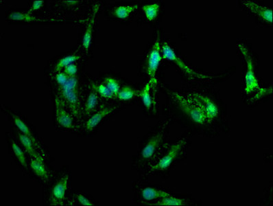 FGFR3 Antibody - Immunofluorescence staining of Hela cells with FGFR3 Antibody at 1:150, counter-stained with DAPI. The cells were fixed in 4% formaldehyde, permeabilized using 0.2% Triton X-100 and blocked in 10% normal Goat Serum. The cells were then incubated with the antibody overnight at 4°C. The secondary antibody was Alexa Fluor 488-congugated AffiniPure Goat Anti-Rabbit IgG(H+L).
