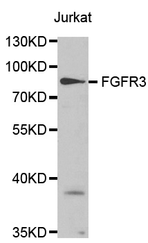 FGFR3 Antibody - Western blot analysis of extracts of Jurkat cell lines.