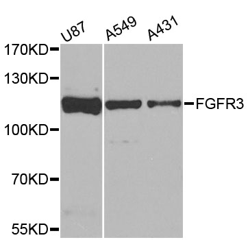 FGFR3 Antibody - Western blot analysis of extracts of various cell lines, using FGFR3 antibody at 1:1000 dilution. The secondary antibody used was an HRP Goat Anti-Rabbit IgG (H+L) at 1:10000 dilution. Lysates were loaded 25ug per lane and 3% nonfat dry milk in TBST was used for blocking. An ECL Kit was used for detection and the exposure time was 90s.