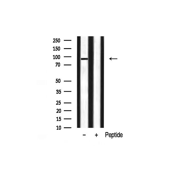 FGFR3 Antibody - Western blot analysis of FGFR3 expression in mouse brain lysate