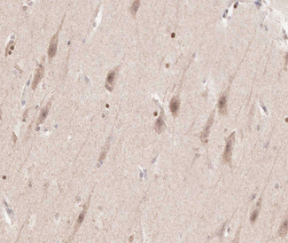 FGFR3 Antibody - 1:100 staining human brain tissue by IHC-P. The tissue was formaldehyde fixed and a heat mediated antigen retrieval step in citrate buffer was performed. The tissue was then blocked and incubated with the antibody for 1.5 hours at 22°C. An HRP conjugated goat anti-rabbit antibody was used as the secondary.