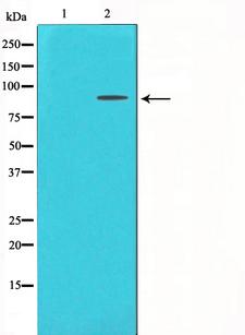 FGFR3 Antibody - Western blot analysis on LOVO cells cell lysates using FGFR3 antibody. The lane on the left is treated with the antigen-specific peptide.
