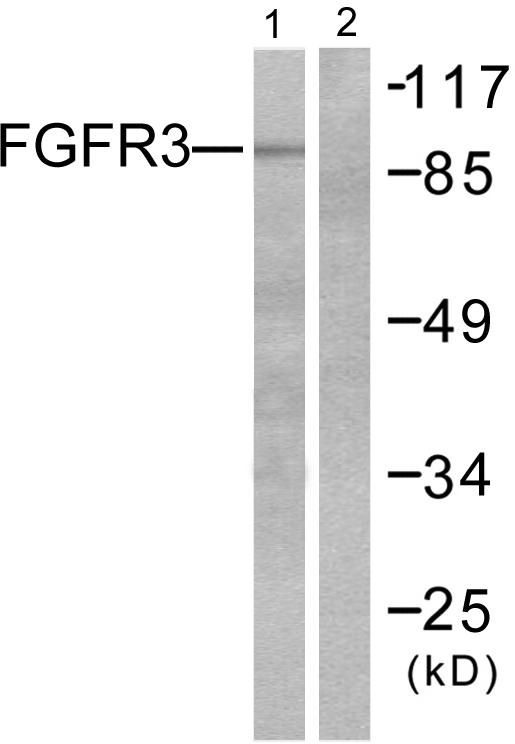 FGFR3 Antibody - Western blot analysis of extracts from LOVO cells, using FGFR3 antibody.