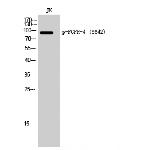 FGFR4 Antibody - Western blot of Phospho-FGFR-4 (Y642) antibody