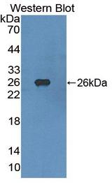 FGFR4 Antibody - Western blot of FGFR4 antibody.