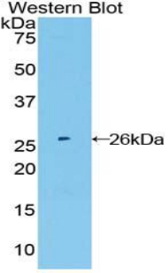 FGFR4 Antibody - Western blot of recombinant FGFR4.  This image was taken for the unconjugated form of this product. Other forms have not been tested.