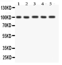 FGFR4 Antibody - FGFR4 antibody Western blot. All lanes: Anti FGFR4 at 0.5 ug/ml. Lane 1: HELA Whole Cell Lysate at 40 ug. Lane 2: PANC Whole Cell Lysate at 40 ug. Lane 3: SGC Whole Cell Lysate at 40 ug. Lane 4: COLO320 Whole Cell Lysate at 40 ug. Lane 5: SW620 Whole Cell Lysate at 40 ug. Predicted band size: 88 kD. Observed band size: 100 kD.