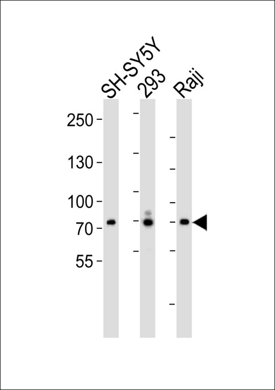 FGFR4 Antibody - Western blot of lysates from SH-SY5Y 293, Raji cell line (from left to right), using FGFR4 Antibody. Antibody was diluted at 1:1000 at each lane. A goat anti-rabbit IgG H&L (HRP) at 1:5000 dilution was used as the secondary antibody. Lysates at 35ug per lane.