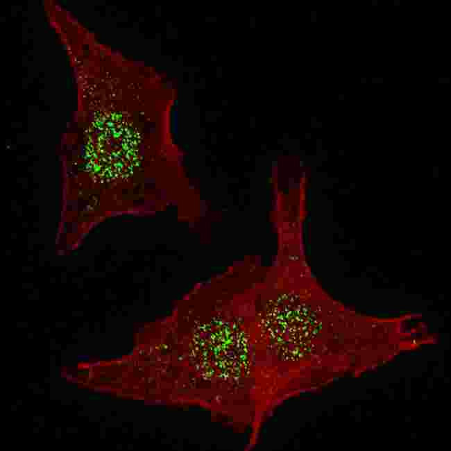 FGFR4 Antibody - Fluorescent confocal image of HeLa cells stained with FGFR4 antibody. HeLa cells were fixed with 4% PFA (20 min), permeabilized with Triton X-100 (0.2%, 30 min). Cells were then incubated FGFR4 primary antibody (1:200, 2 h at room temperature). For secondary antibody, Alexa Fluor 488 conjugated donkey anti-rabbit antibody (green) was used (1:1000, 1h). Nuclei were counterstained with Hoechst 33342 (blue) (10 ug/ml, 5 min). Note the highly specific localization of the FGFR4 mainly to the nucleus, supported by Human Protein Atlas Data (http://www.proteinatlas.org/ENSG00000160867).