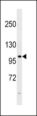 FGFR4 Antibody - FGFR4 Antibody (E39) western blot of 293 cell line lysates (35 ug/lane). The FGFR4 antibody detected the FGFR4 protein (arrow).