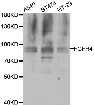 FGFR4 Antibody - Western blot analysis of extracts of various cell lines.