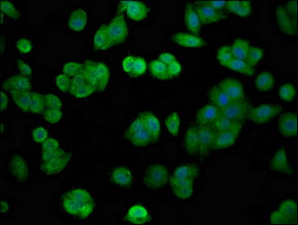 FGFR4 Antibody - Immunofluorescence staining of HepG2 cells at a dilution of 1:100, counter-stained with DAPI. The cells were fixed in 4% formaldehyde, permeabilized using 0.2% Triton X-100 and blocked in 10% normal Goat Serum. The cells were then incubated with the antibody overnight at 4 °C.The secondary antibody was Alexa Fluor 488-congugated AffiniPure Goat Anti-Rabbit IgG (H+L) .