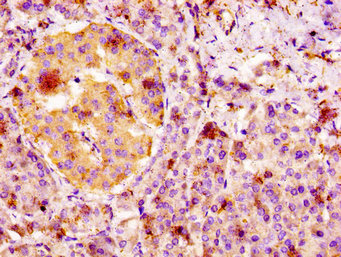FGFR4 Antibody - Immunohistochemistry image at a dilution of 1:100 and staining in paraffin-embedded human pancreatic tissue performed on a Leica BondTM system. After dewaxing and hydration, antigen retrieval was mediated by high pressure in a citrate buffer (pH 6.0) . Section was blocked with 10% normal goat serum 30min at RT. Then primary antibody (1% BSA) was incubated at 4 °C overnight. The primary is detected by a biotinylated secondary antibody and visualized using an HRP conjugated SP system.