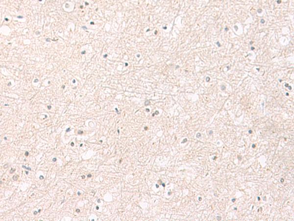 FGFR4 Antibody - Immunohistochemistry of paraffin-embedded Human brain tissue  using FGFR4 Polyclonal Antibody at dilution of 1:25(×200)