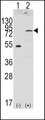 FGFR4 Antibody - Western blot of FGFR4 (arrow) using rabbit polyclonal FGFR4 Antibody. 293 cell lysates (2 ug/lane) either nontransfected (Lane 1) or transiently transfected with the FGFR4 gene (Lane 2) (Origene Technologies).