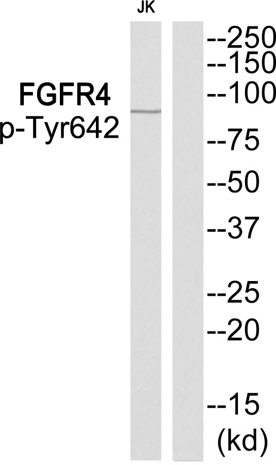 FGFR4 Antibody - Western blot of extracts from Jurkat cells, using FGFR4 (Phospho-Tyr642) antibody.