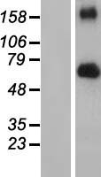 FGFR4 Protein - Western validation with an anti-DDK antibody * L: Control HEK293 lysate R: Over-expression lysate