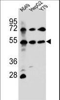FGFRL1 Antibody - FGFRL1 Antibody western blot of A549,HepG2,Y79 cell line lysates (35 ug/lane). The FGFRL1 antibody detected the FGFRL1 protein (arrow).