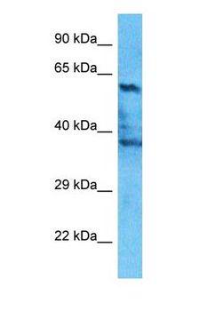 FGFRL1 Antibody - Western blot of FGFRL1 Antibody with human HepG2 Whole Cell lysate.  This image was taken for the unconjugated form of this product. Other forms have not been tested.