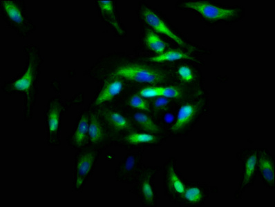 FGFRL1 Antibody - Immunofluorescence staining of Hela cells at a dilution of 1:166, counter-stained with DAPI. The cells were fixed in 4% formaldehyde, permeabilized using 0.2% Triton X-100 and blocked in 10% normal Goat Serum. The cells were then incubated with the antibody overnight at 4 °C.The secondary antibody was Alexa Fluor 488-congugated AffiniPure Goat Anti-Rabbit IgG (H+L) .