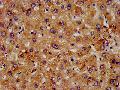 FGFRL1 Antibody - Immunohistochemistry image at a dilution of 1:500 and staining in paraffin-embedded human liver tissue performed on a Leica BondTM system. After dewaxing and hydration, antigen retrieval was mediated by high pressure in a citrate buffer (pH 6.0) . Section was blocked with 10% normal goat serum 30min at RT. Then primary antibody (1% BSA) was incubated at 4 °C overnight. The primary is detected by a biotinylated secondary antibody and visualized using an HRP conjugated SP system.