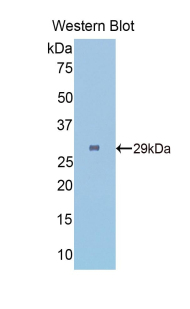 FGG / Fibrinogen Gamma Antibody - Western blot of recombinant FGG / Fibrinogen Gamma.  This image was taken for the unconjugated form of this product. Other forms have not been tested.