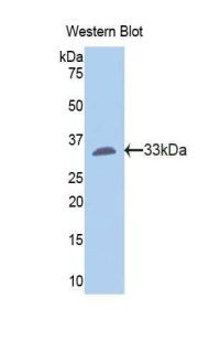FGG / Fibrinogen Gamma Antibody - Western blot of recombinant FGG / Fibrinogen Gamma.  This image was taken for the unconjugated form of this product. Other forms have not been tested.