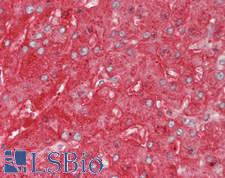 FGG / Fibrinogen Gamma Antibody - Human Liver: Formalin-Fixed, Paraffin-Embedded (FFPE).  This image was taken for the unconjugated form of this product. Other forms have not been tested.