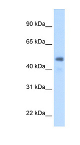 FGG / Fibrinogen Gamma Antibody - FGG antibody ARP44300_T100-NP_000500-FGG(fibrinogen gamma chain) Antibody Western blot of Fetal Liver lysate.  This image was taken for the unconjugated form of this product. Other forms have not been tested.