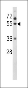 FGG / Fibrinogen Gamma Antibody - Western blot of FIBG Antibody in NCI-H460 cell line lysates (35 ug/lane). FIBG (arrow) was detected using the purified antibody.
